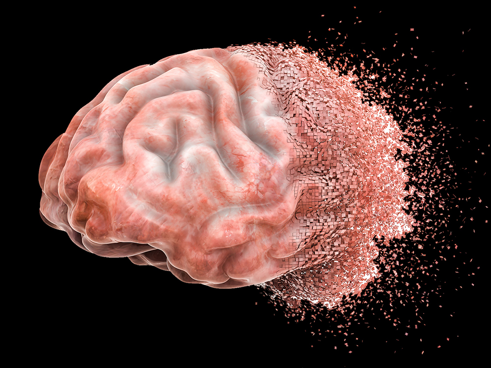Brain Disease Or Destruction, Memory Loss Concept. 3d Rendering A rendering of a brain breaking apart into small pieces