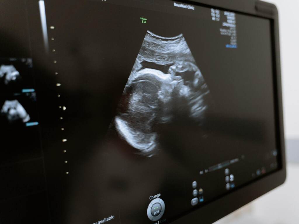Vaccinating pregnant women against the coronavirus also helps protect their babies against COVID-19 after they are born, according to new research. Vaccinating pregnant women against the coronavirus also helps protect their babies against COVID-19 after they are born, according to new research. (Pexels)