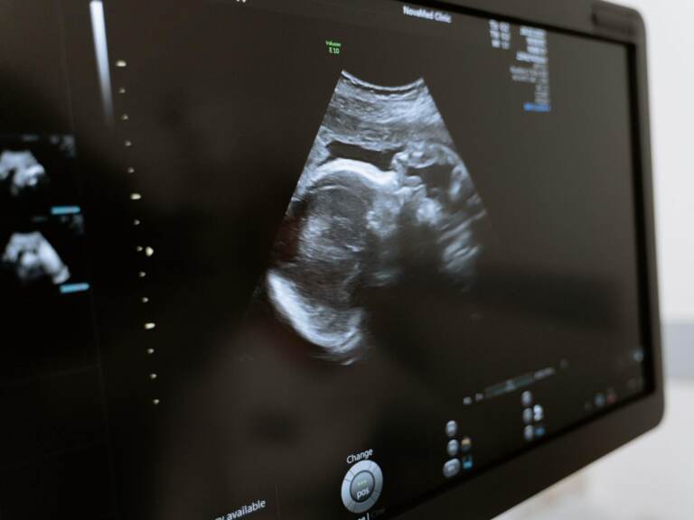 Vaccinating pregnant women against the coronavirus also helps protect their babies against COVID-19 after they are born, according to new research. (Pexels)