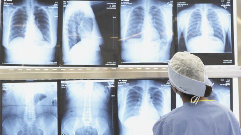 A health worker views MRIs