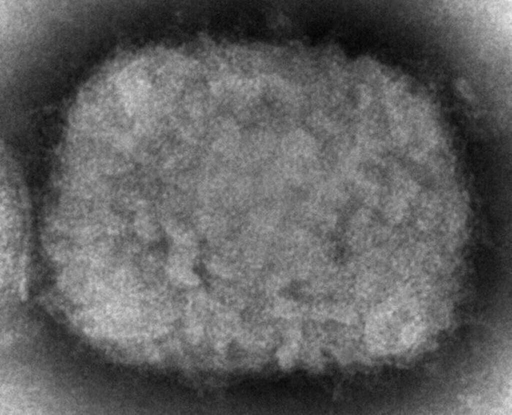 Monkeypox Vaccines A 2003 electron microscope image shows a monkeypox virion.