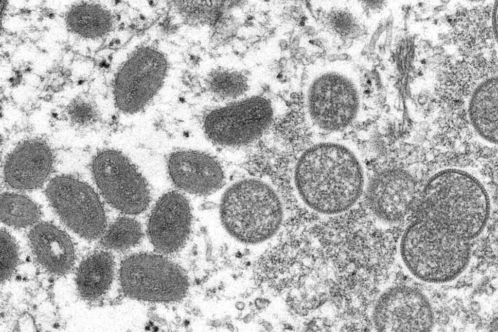 Africa Monkeypox Mature, oval-shaped monkeypox virions, left, and spherical immature virions, right.