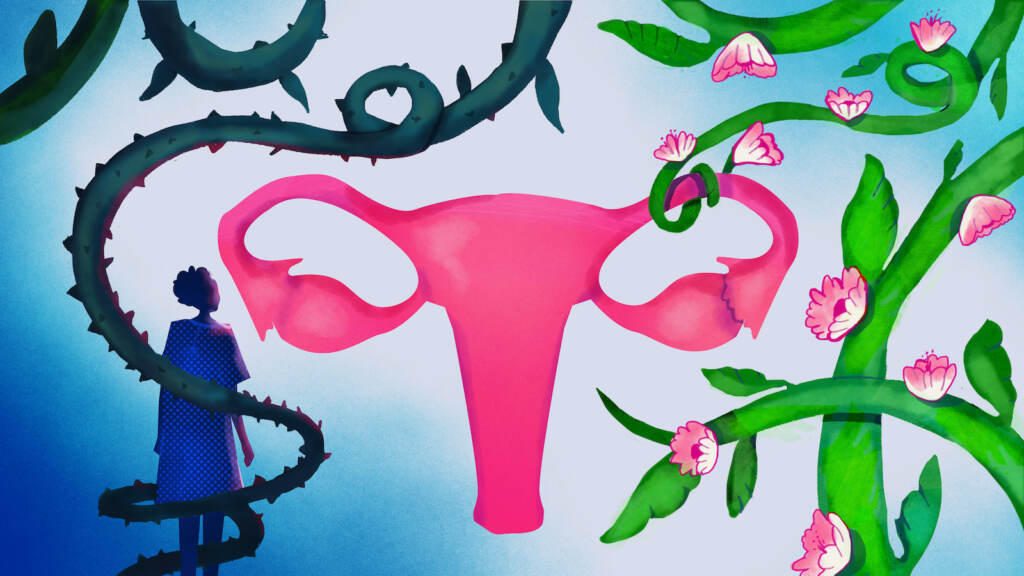 tubal-ligation-npr_wide-bd036d89b9d6f6dc7a58efb121efa0a077d777c8 An illustration of fallopian tubes.