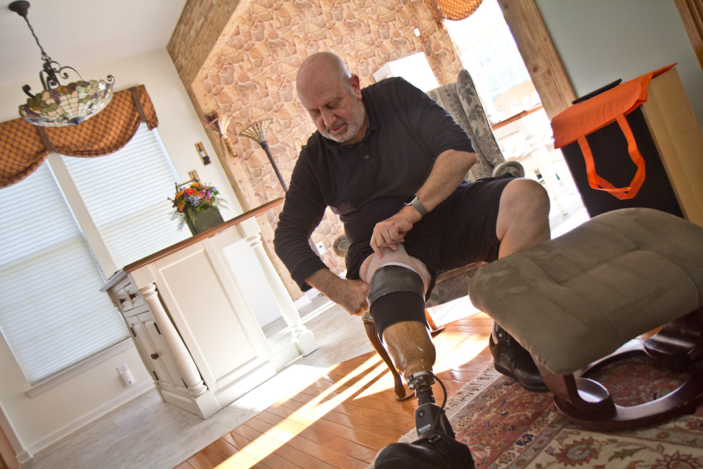 2021 11 18 k paynter ed nathan, prosthetic home tour-8 (1).jpg Ed Nathan pulls up the liner, socks he uses to protect his leg from rubbing, and the compression sleeve of his prosthetic limb. (Kimberly Paynter/WHYY)