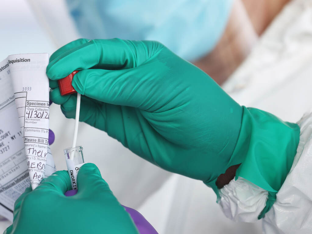 The majority of people likely infected with the omicron variant of COVID-19 were unaware, according to a study from a medical center in Los Angeles, Calif. The majority of people likely infected with the omicron variant of COVID-19 were unaware, according to a study from a medical center in Los Angeles, Calif. (Al Bello/Getty Images)