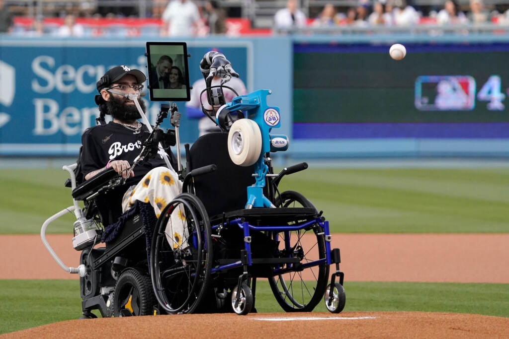 Anthony Carbajal Anthony Carbajal, who is battling ALS (Lou Gehrig's disease) throws out the ceremonial first pitch with the help of a pitching machine prior to a baseball game between the Los Angeles Dodgers and the New York Mets Thursday, June 2, 2022, in Los Angeles. (AP Photo/Mark J. Terrill)