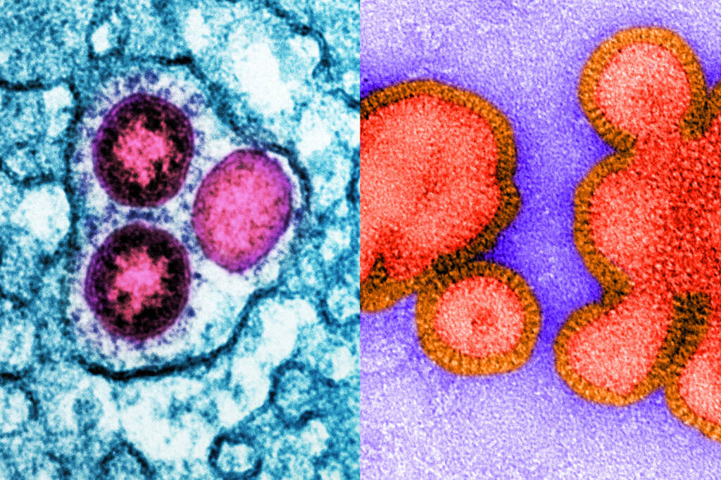 twindemic1_slide-ed64b4f3c7242f41066f29a9423808916e7cba29-s1600-c85 Up-close slides show virus particles.