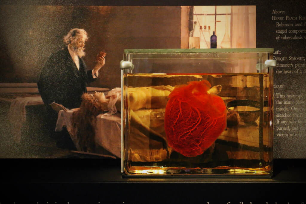 A heart dyed red is displayed in a glass display case.