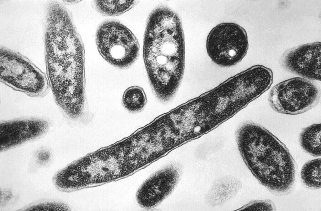 A microscopic image of Legionnaire's disease-causing particles.