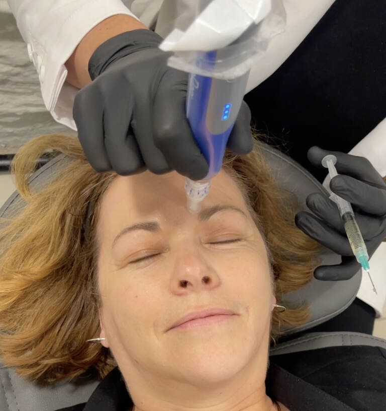 The Pulse host Maiken Scott receives a microneedling treatment based on stem cells that's designed to stimulate collagen and elastin production in the skin. (Courtesy of Maiken Scott)