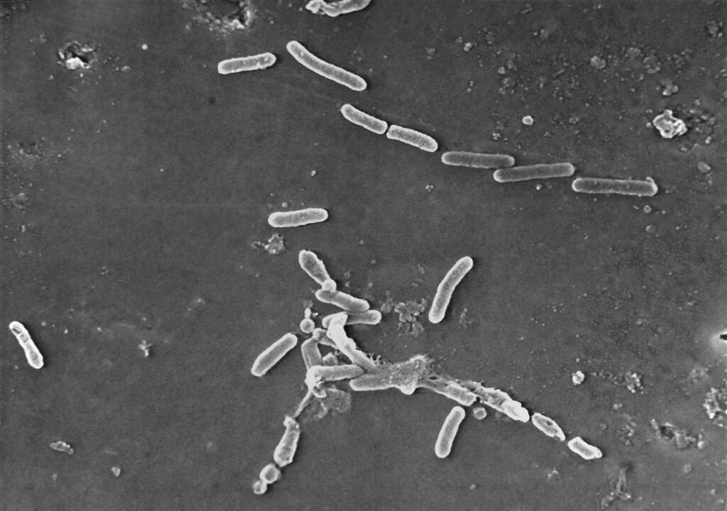 Eye Drops Infections FILE - This scanning electron microscope image made available by the Centers for Disease Control and Prevention shows rod-shaped Pseudomonas aeruginosa bacteria. U.S. health officials are advising people to stop using the over-the-counter eye drops, EzriCare Artificial Tears, that have been linked to an outbreak of drug-resistant infections of Pseudomonas aeruginosa. The Centers for Disease Control and Prevention on Wednesday night, Feb. 1, 2023, sent a health alert to physicians, saying the outbreak includes at least 55 people in 12 states. One died. (Janice Haney Carr/CDC via AP)