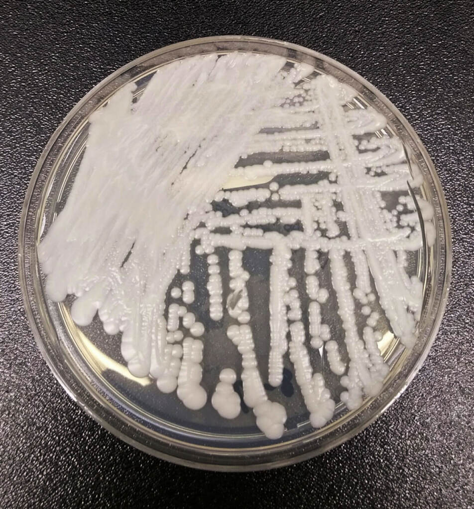 This undated photo made available by the Centers for Disease Control and Prevention shows a strain of Candida auris cultured in a petri dish