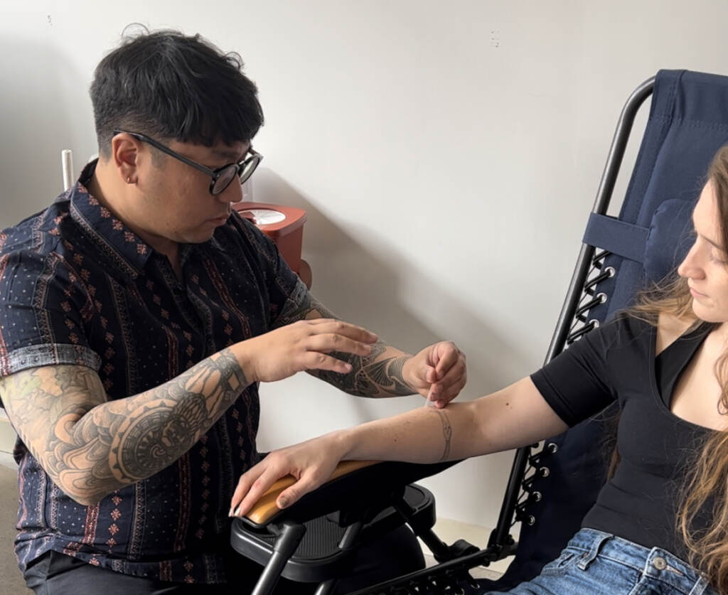 Tyler Phan prepares to give a patient acupuncture. Credit: Nikie Belliveau