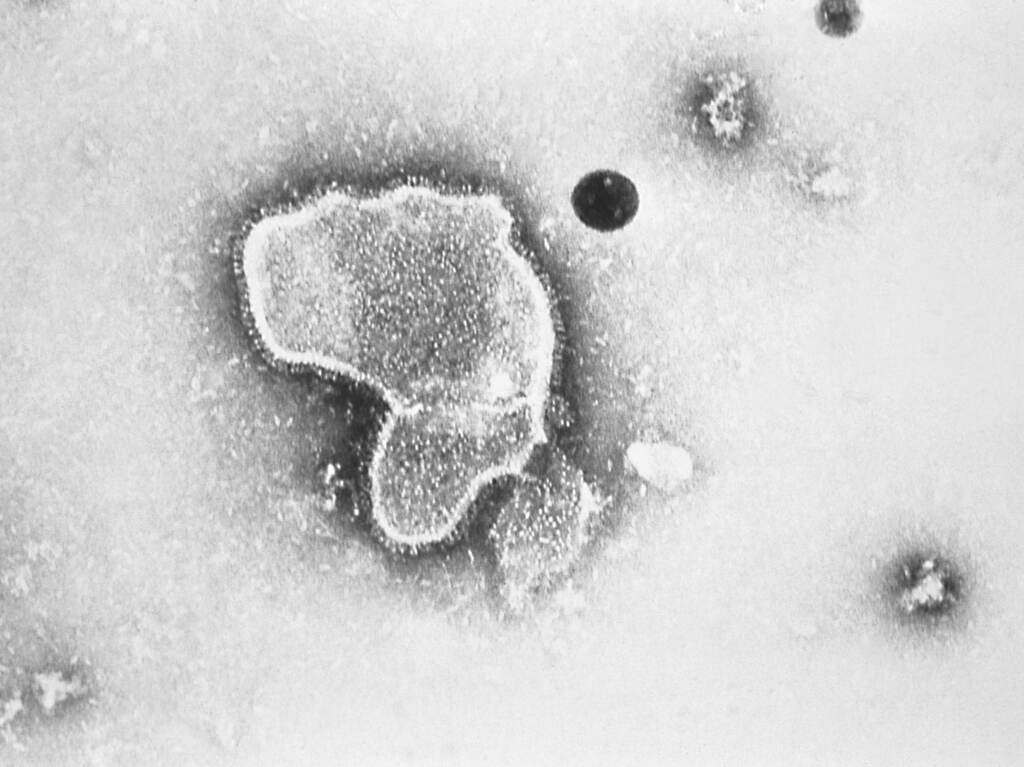 An electron micrograph of Respiratory Syncytial Virus, also known as RSV, which is the leading cause of hospitalizations among infants in the U.S. An electron micrograph of Respiratory Syncytial Virus, also known as RSV, which is the leading cause of hospitalizations among infants in the U.S.