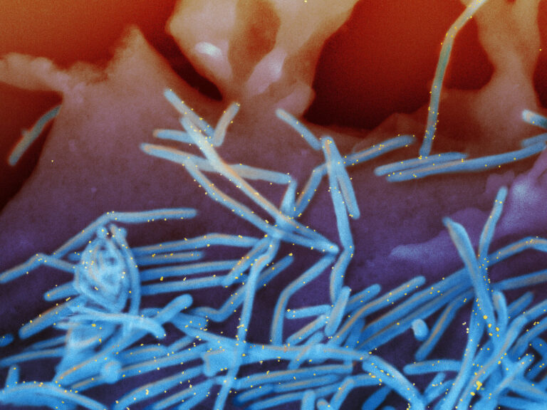 An image of RSV virus