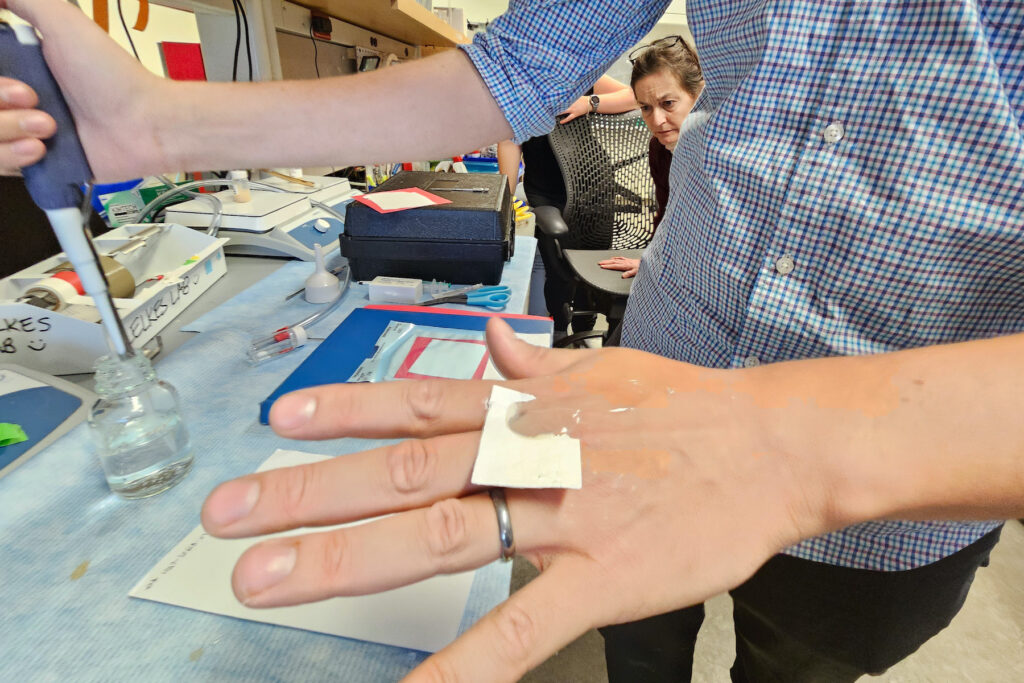 OmegaSkin on someone's hand