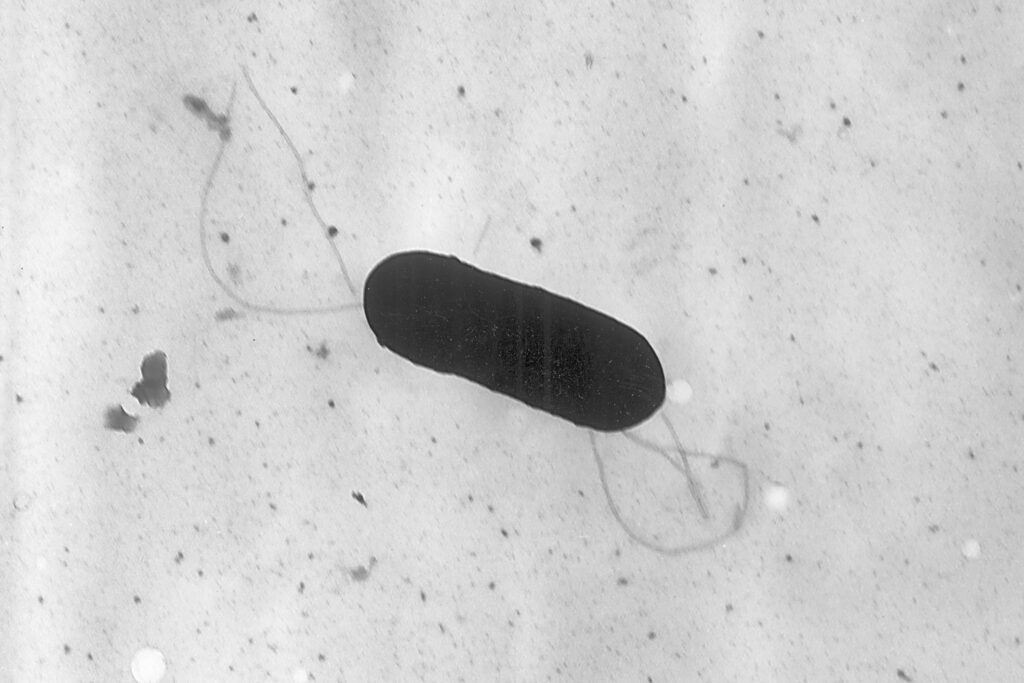 Listeria-Deli Meats Listeria under a microscope