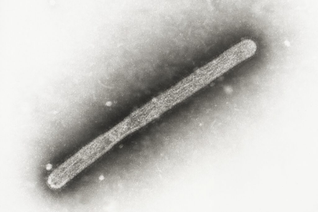 avian-flu-electron-microscope an electron microscope image shows an avian influenza A H5N1 virion