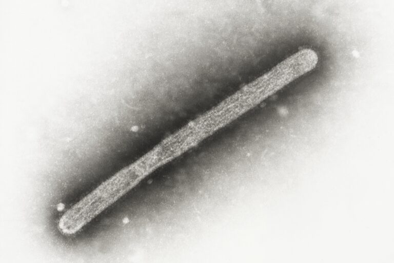 an electron microscope image shows an avian influenza A H5N1 virion