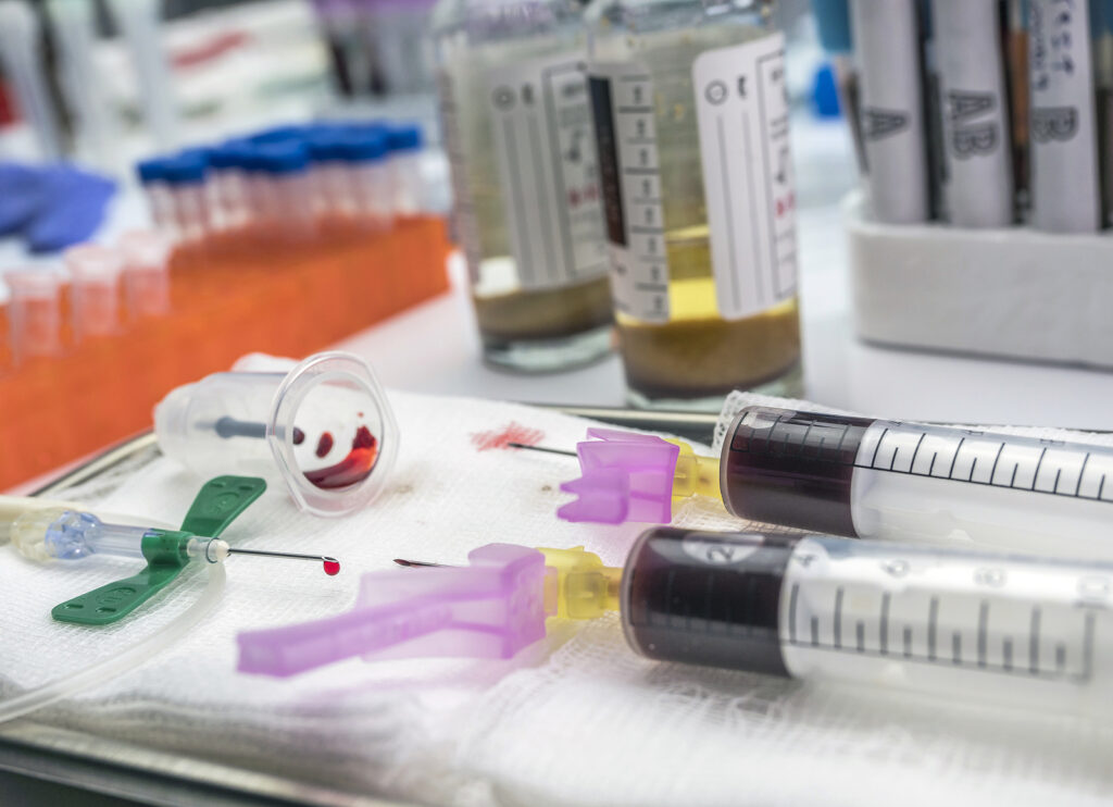 Aerobic And Anaerobic Blood Culture Sampling In A Hospital, Spai Needles and bottles for sampling blood cultures