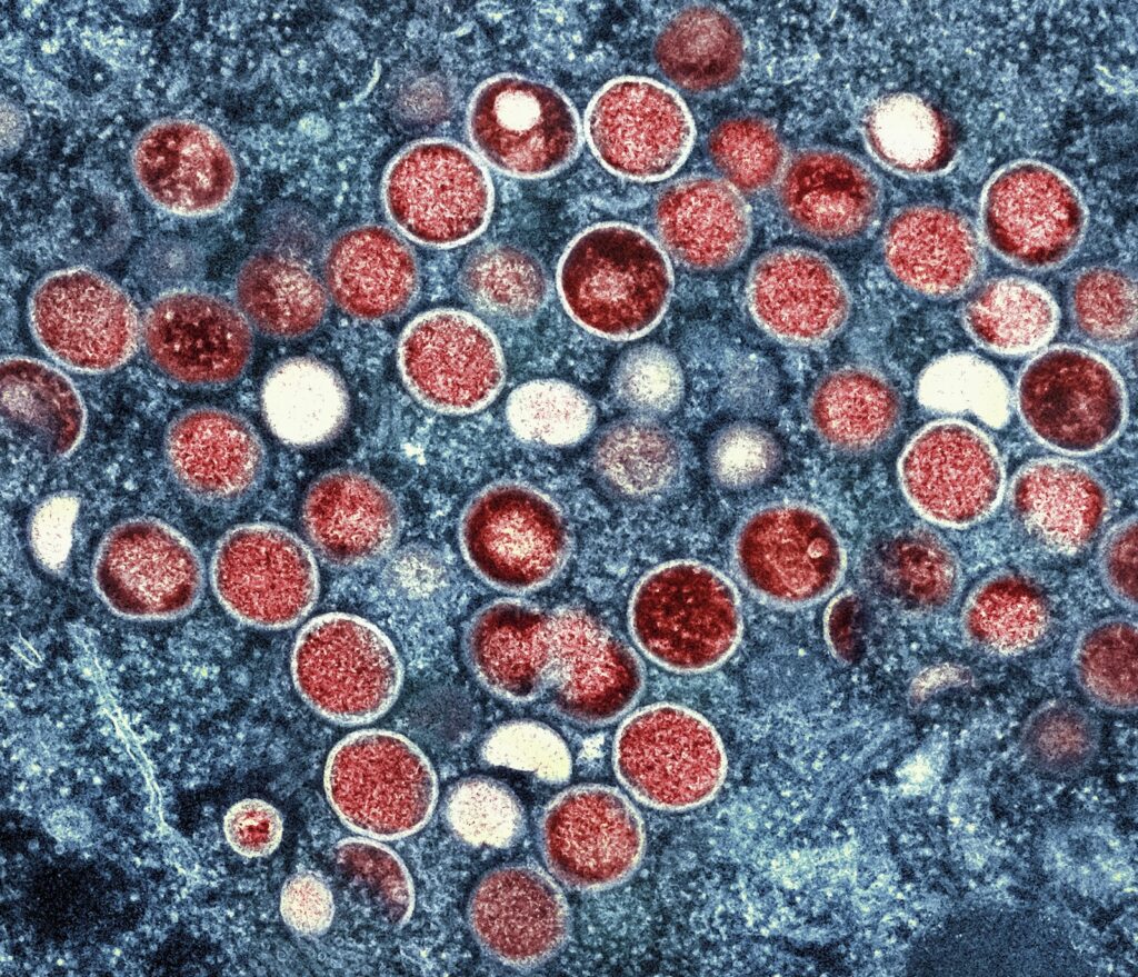 MED WHO Mpox This undated image provided by the National Institute of Allergy and Infectious Diseases shows a colorized transmission electron micrograph of mpox particles (red) found within an infected cell (blue), cultured in the laboratory that was captured and color-enhanced at the NIAID Integrated Research Facility in Fort Detrick, Md.