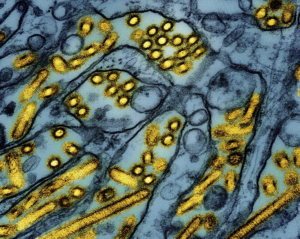 Bird Flu This colorized electron microscope image released by the National Institute of Allergy and Infectious Diseases on March 26, 2024, shows avian influenza A H5N1 virus particles (yellow), grown in Madin-Darby Canine Kidney (MDCK) epithelial cells (blue).