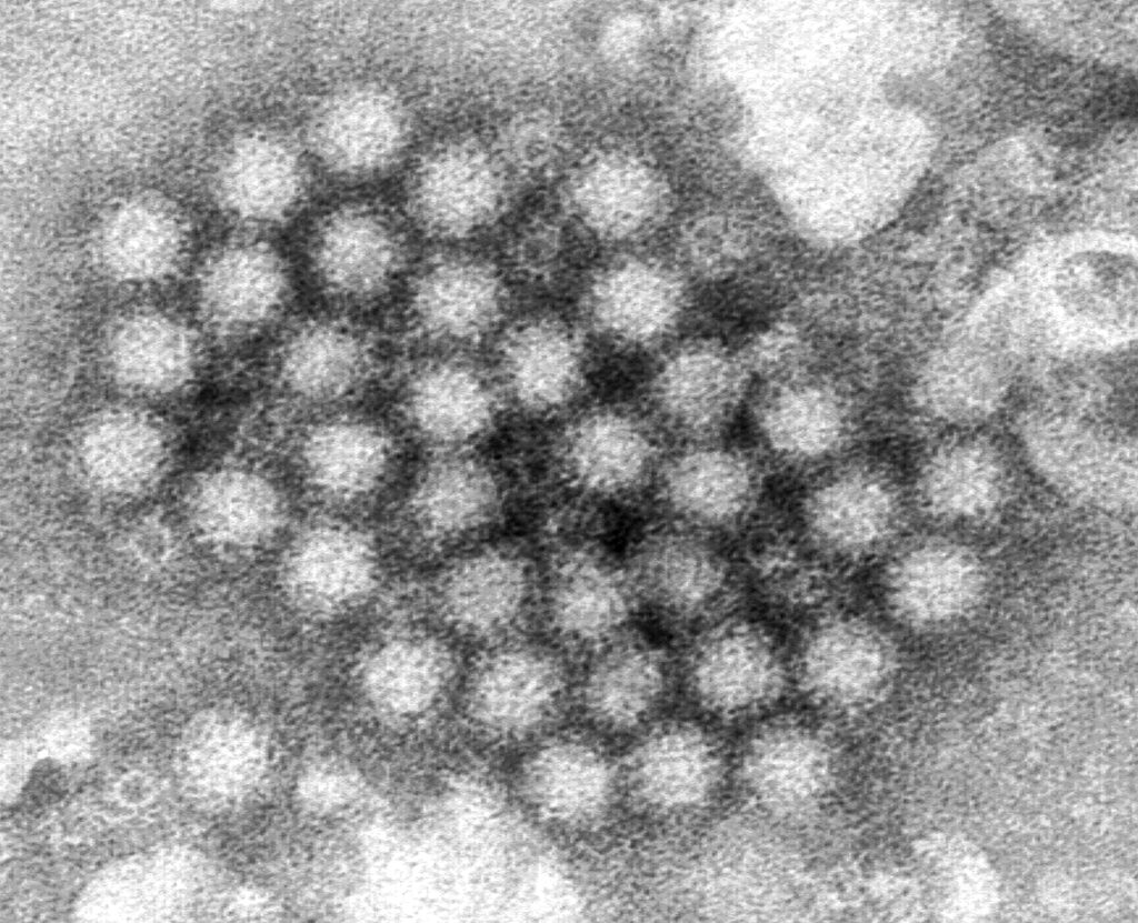 Norovirus Explainer This electron microscope image provided by the Centers for Disease Control and Prevention shows a cluster of norovirus virions.