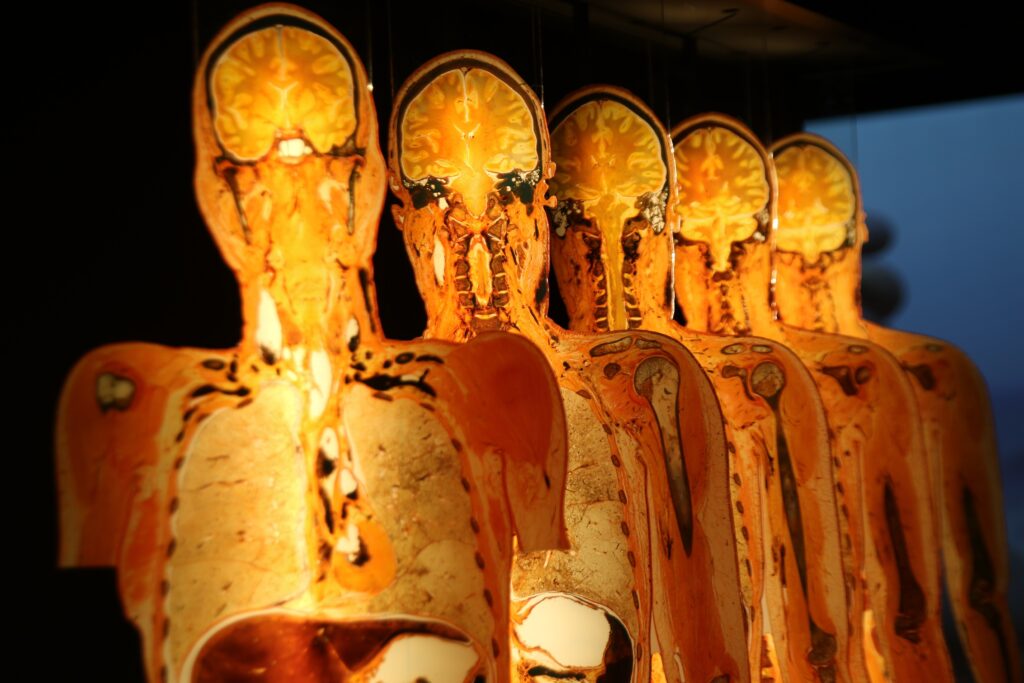 body-worlds-franklin-institute-2025-02-16-20 five recreations of human brains and torsos