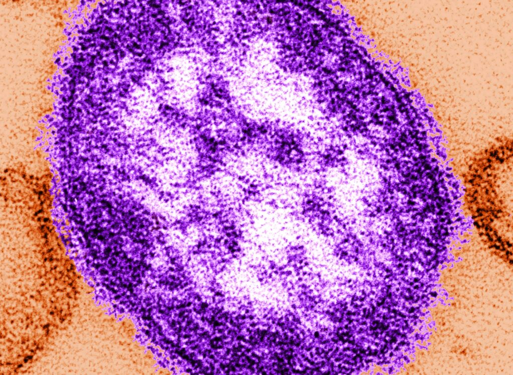 measles-virus-particle-file measles under a microscope