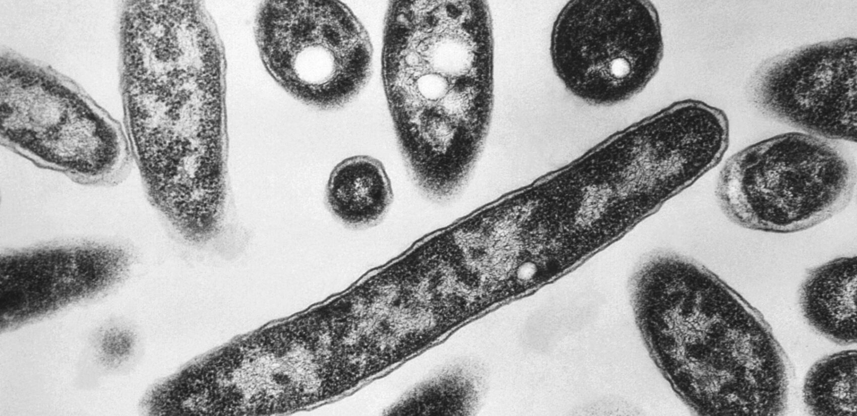 Legionella pneumophila bacteria