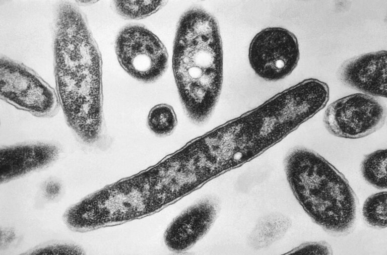 Legionella pneumophila bacteria