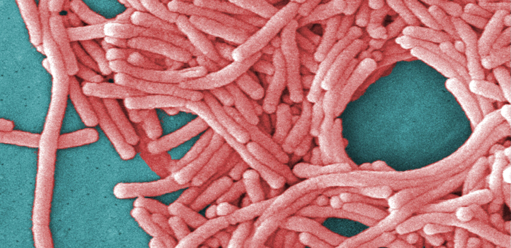 a large grouping of Legionella pneumophila