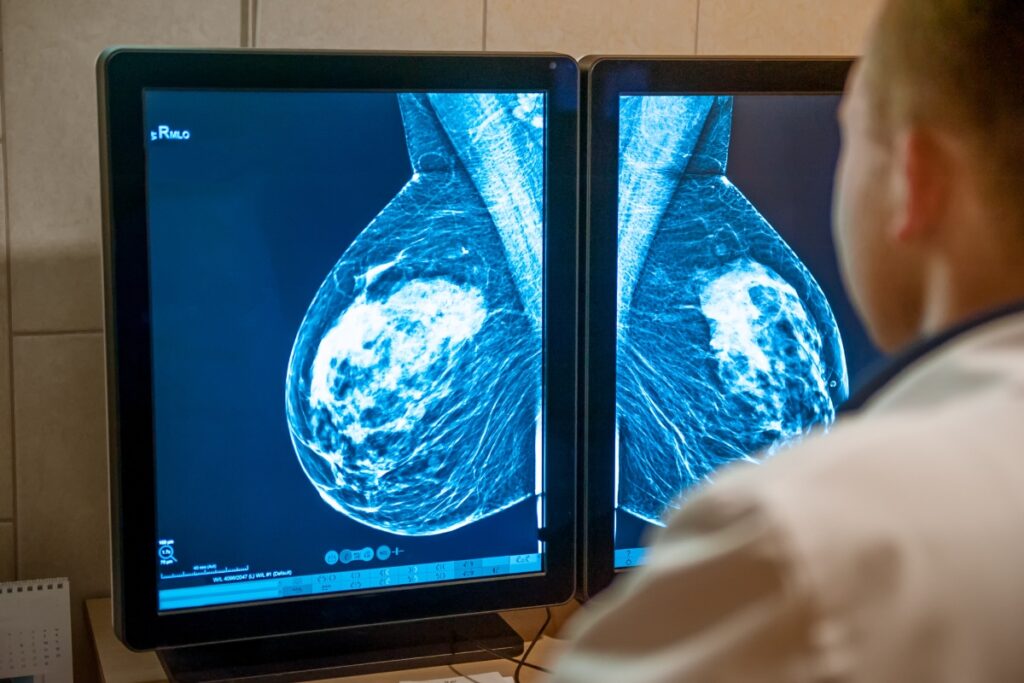 Breast Cancer Awareness Penn Researchers offer hope thanks to a major discovery on how to identify so-called cancer sleeper cells. Are we getting closer to a cure?
