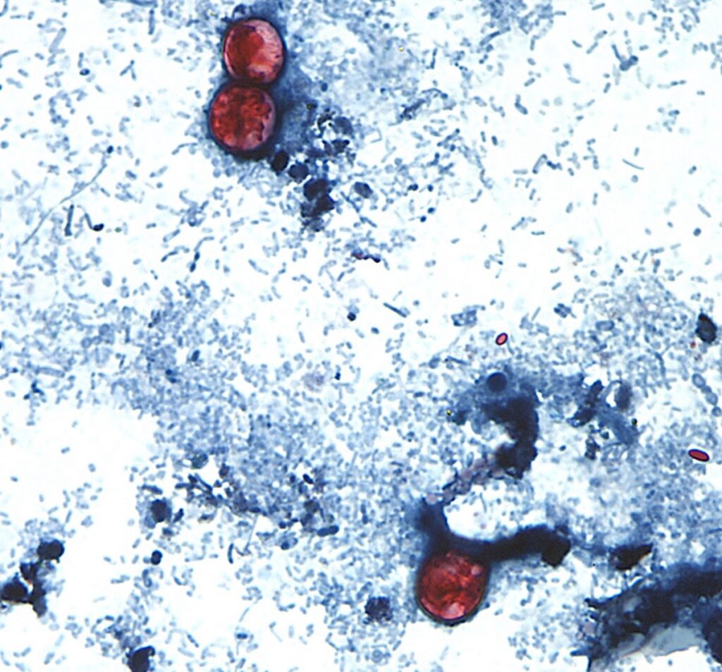 A view of a stool sample seen through a microscope with a parasite present.